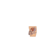 Understanding Prostatitis: A Guide to Inflammation, Infection, and Precision Management