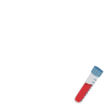 While the Stockholm3 test is currently being evaluated by NICE and used in various private settings, it is not yet the standard across all NHS trusts. Mr Collins offers this advanced diagnostic tool to his private patients in Manchester and Cheshire to provide the highest level of diagnostic accuracy.