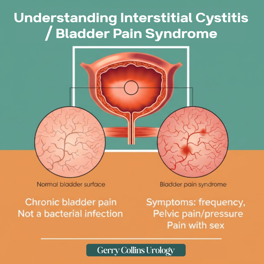 Understanding Interstitial Cystitis / Bladder Pain Syndrome (BPS)